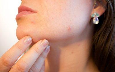 Little Spots, Big Problems: Treating Skin Conditions