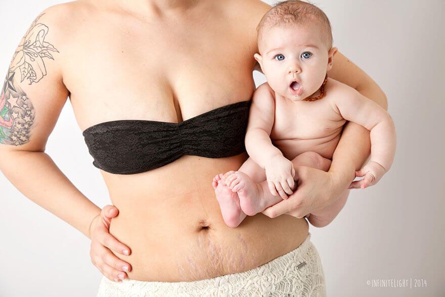 Post Pregnancy Belly or Summer Slimming?