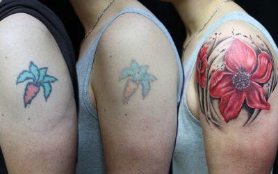 Is it Time for Laser Tattoo Removal?