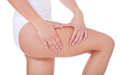 All You Need To Know About Cellulite